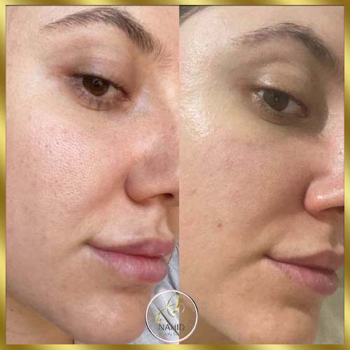 گالری پاکسازی پوست